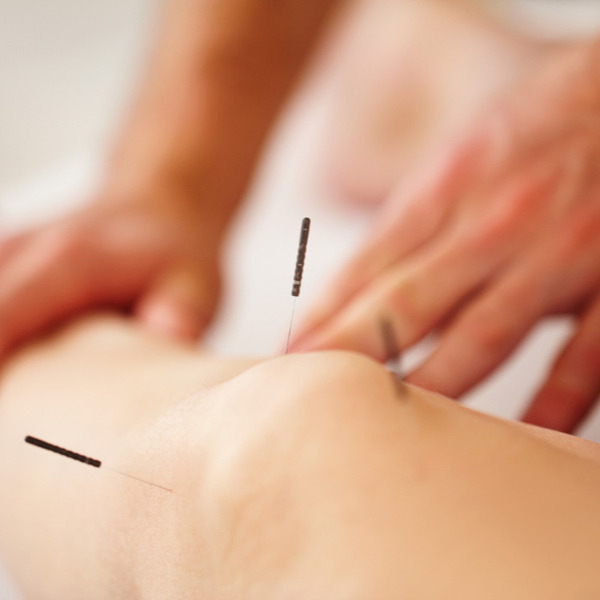 Dry Needling and Trigger Point Therapy